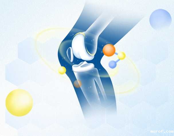 保护关节，SAMe或许能帮到你