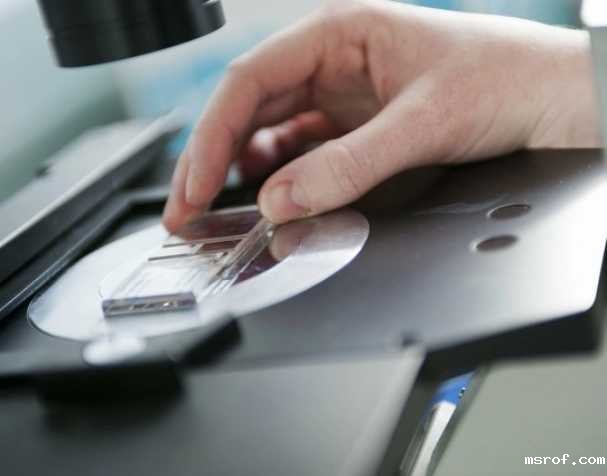 SAMe或成慢性结肠炎新希望? SAMe或成慢性结肠炎新希望?